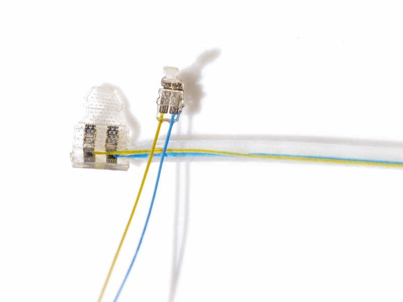 Against the Storm with the Vagus Nerve