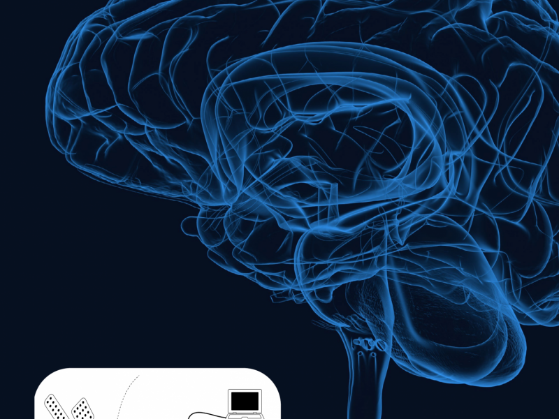 Brain Interchange&trade; System Sets a New Standard