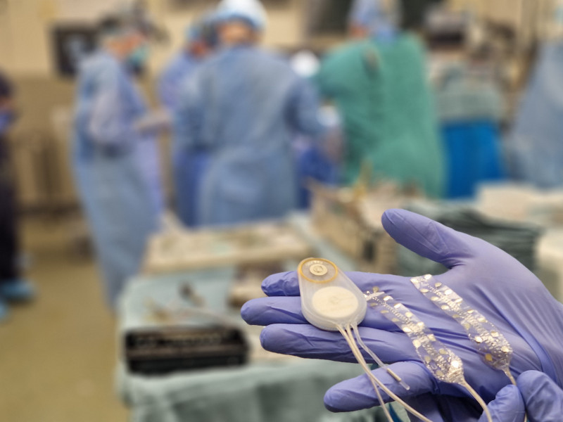CorTec Announces Neurotech Milestone: First Human Implantation of a Brain-Computer Interface made in Germany