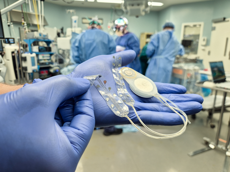 CorTec Announces Successful Second Human Implantation of Its Brain-Computer Interface (BCI) System