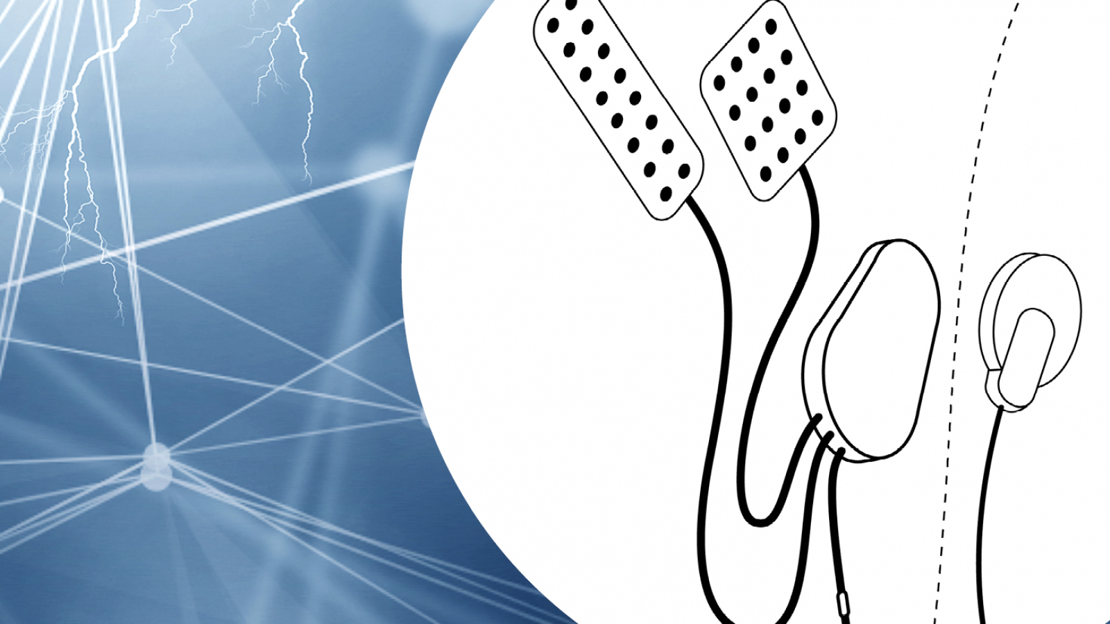 The Brain Interchange&trade; System for Stroke Rehabilitation