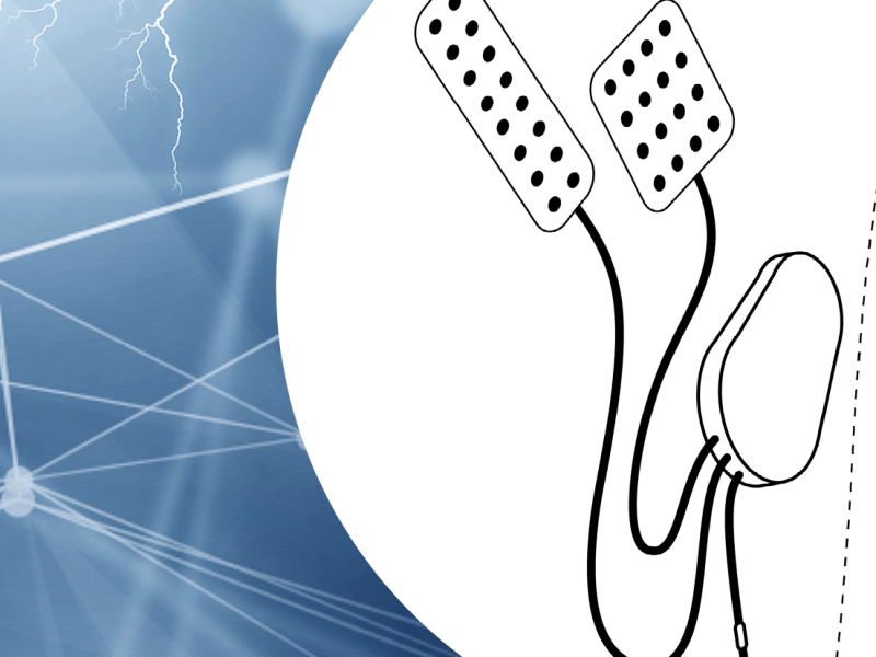The Brain Interchange&trade; System for Stroke Rehabilitation