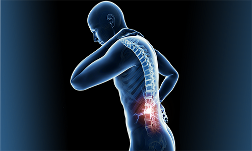 Spinal Cord Stimulation for Back Pain